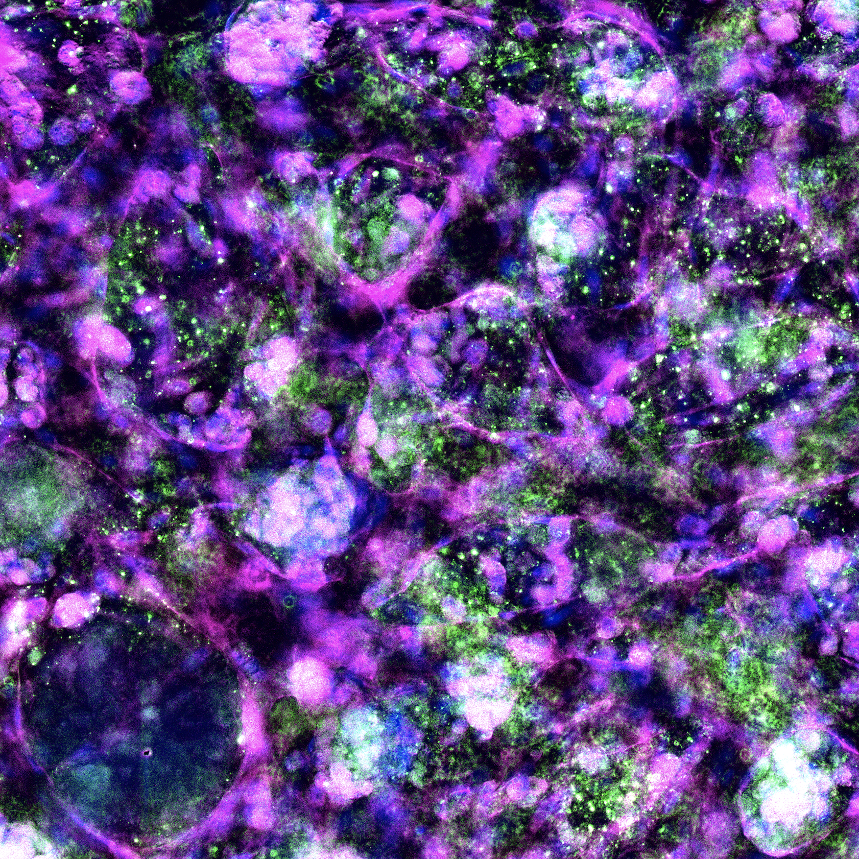 Liver Tissueoid-on-a-chip