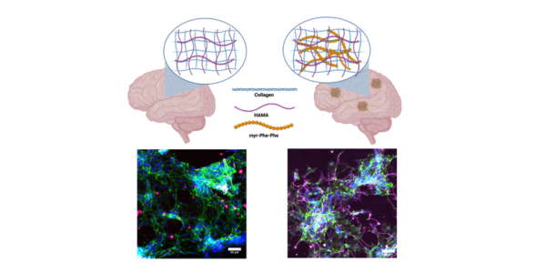 Groundbreaking Study Reveals Insights into Alzheimer's Disease Mechanisms Through Novel Hydrogel Matrix